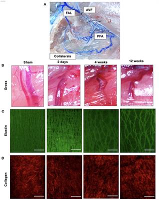 Simultaneous Upregulation of Elastolytic and Elastogenic Factors Are Necessary for Regulated Collateral Diameter Expansion